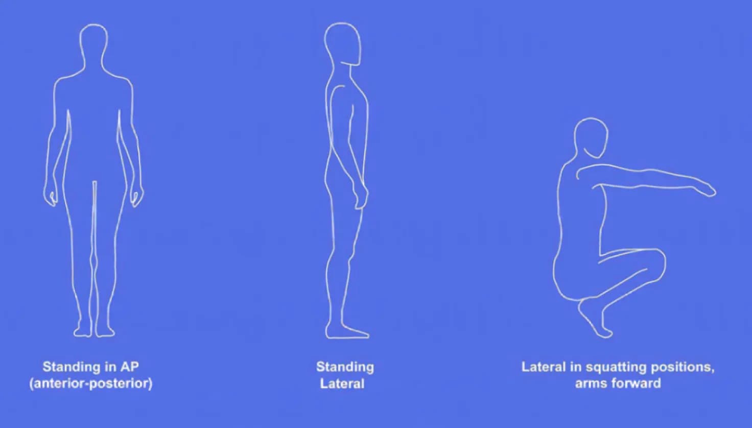 Indications for limb lengthening