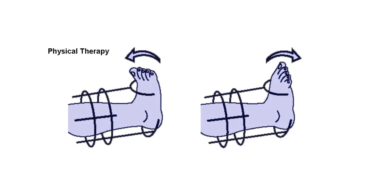 Physical therapy
